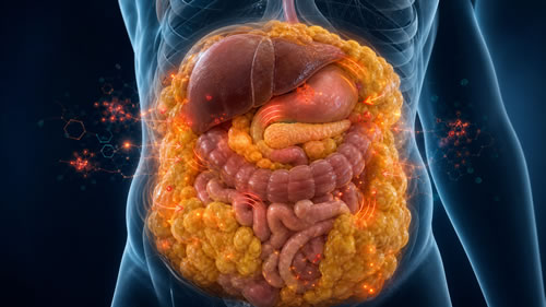 PHIX y grasa visceral rodeando órganos abdominales